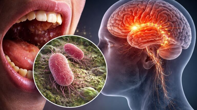 The Parkinson’s disease trigger may be this well‑known mouth bacterium